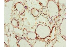 Immunohistochemistry of paraffin-embedded human thyroid tissue using ABIN7151127 at dilution of 1:100
