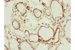 Immunohistochemistry of paraffin-embedded human thyroid tissue using ABIN7151127 at dilution of 1:100 (RNF114 anticorps  (AA 1-228))