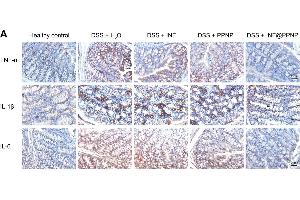 (A) Immunohistochemical staining for TNF-α, IL-1β, and IL-6 in colon tissues of different groups. (IL-6 anticorps  (AA 30-212))
