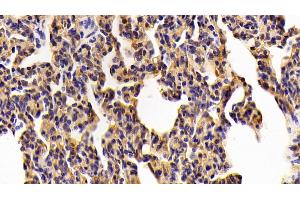 Detection of TLR2 in Porcine Lung Tissue using Polyclonal Antibody to Toll Like Receptor 2 (TLR2) (TLR2 anticorps  (AA 47-245))