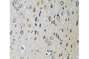 Immunohistochemistry of paraffin-embedded Rat brain using PTPRE Polyclonal Antibody at dilution of 1:100 (40x lens).