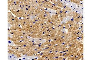 Immunohistochemistry analysis of paraffin-embedded mouse heart using TNNT2 Polyclonal Antibody at dilution of 1:200. (Cardiac Troponin T2 anticorps)