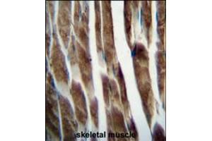 ILKAP Antibody immunohistochemistry analysis in formalin fixed and paraffin embedded human skeletal muscle followed by peroxidase conjugation of the secondary antibody and DAB staining. (ILKAP anticorps  (AA 243-270))