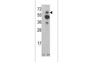 Western blot analysis of ACK1 (arrow) using rabbit polyclonal ACK1 Antibody (N-term) (ABIN392082 and ABIN2841841).