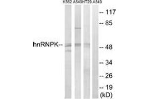 Western blot analysis of extracts from K562/A549/HT-29 cells, using hnRNP K (Ab-284) Antibody. (HNRNPK anticorps  (AA 250-299))