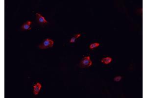 ABIN6266458 staining MCF-7 cells by IF/ICC.