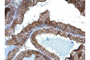 IHC-P Image alpha Adducin antibody detects alpha Adducin protein at membrane on mouse prostate by immunohistochemical analysis. (alpha Adducin anticorps)