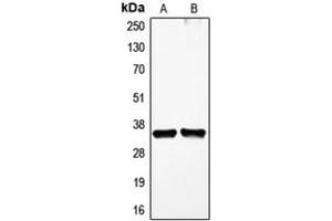Western blot analysis of VEGFD expression in HDMEC (A), HEK293T (B) whole cell lysates.