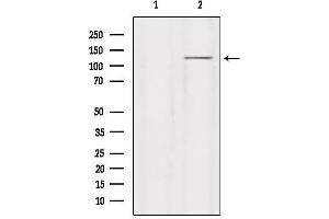 Western blot analysis of extracts from HepG2, using GRID2 Antibody. (GRID2 anticorps  (C-Term))