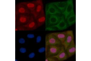 XRRA1 Mouse Monoclonal Antibody staining Hela cells by IF/ICC. (XRRA1 anticorps)