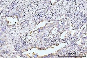 IHC analysis of RPL29 using anti-RPL29 antibody (ABIN7600993). (RPL29 anticorps  (AA 27-153))