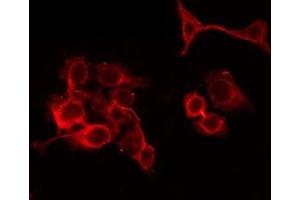 ABIN6279648 staining Hela by IF/ICC. (PAOX anticorps  (Internal Region))