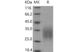 Western Blotting (WB) image for CD83 (CD83) (AA 1-133) protein (His tag) (ABIN7320187)
