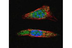 Confocal immunofluorescent analysis of SUMO1 antibody with A375 cells followed by Alexa Fluor 488-conjugated goat anti-rabbit lgG (green).