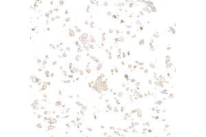 Immunocytochemistry (ICC) image for anti-Met Proto-Oncogene (MET) (C-Term) antibody (ABIN7795683) (Recombinant c-MET anticorps  (C-Term))