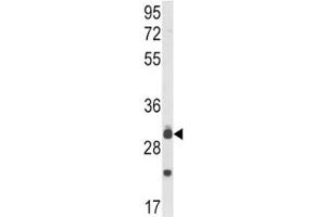 Western blot analysis of MyD88 antibody and mouse lung tissue lysate.