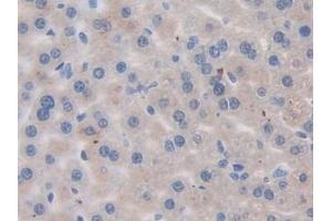 Detection of ErbB3 in Mouse Liver Tissue using Polyclonal Antibody to V-Erb B2 Erythroblastic Leukemia Viral Oncogene Homolog 3 (ErbB3)