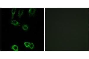 Immunofluorescence analysis of A549 cells, using CNN2 Antibody. (CNN2 anticorps  (AA 121-170))