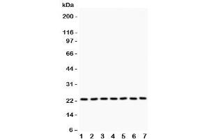 Western blot testing of GSTP1 antibody and Lane 1:  rat brain (GSTP1 anticorps  (AA 2-210))