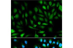 Immunofluorescence analysis of HeLa cells using PARK7 Polyclonal Antibody (PARK7/DJ1 anticorps)