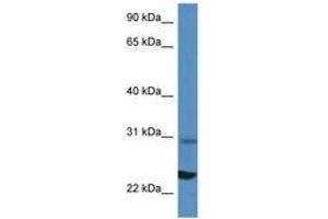 Image no. 1 for anti-Ribosomal Protein L17 (RPL17) (N-Term) antibody (ABIN6746438) (RPL17 anticorps  (N-Term))