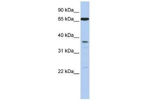 ABCB9 antibody used at 1 ug/ml to detect target protein. (ABCB9 anticorps)