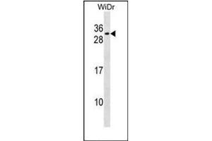 Western blot analysis of ANKRA1 / RFXANK Antibody  in WiDr cell line lysates (35ug/lane). (RFXANK anticorps  (Middle Region))