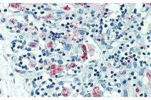 Detection of MARCO in Human Thymus Tissue using Polyclonal Antibody to Macrophage Receptor With Collagenous Structure (MARCO)