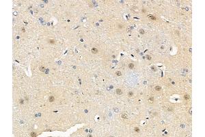 ABIN6255748 and ABIN6267180 at 1/100 staining Rat brain tissue by IHC-P.