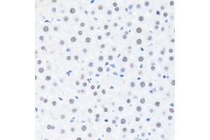 Immunohistochemistry of paraffin-embedded rat liver using BRMS1 antibody (ABIN7265929) at dilution of 1:100 (40x lens). (BRMS1 anticorps  (AA 90-210))
