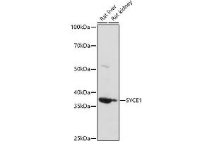 Western blot analysis of extracts of various cell lines, using (ABIN6132916, ABIN6148756, ABIN6148757 and ABIN6223050) at 1:1000 dilution. (SYCE1 anticorps  (AA 132-351))