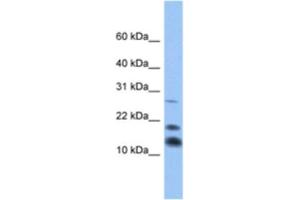Western Blotting (WB) image for anti-C1D Nuclear Receptor Corepressor (C1D) antibody (ABIN2463345) (C1D anticorps)