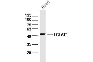 Mouse heart lysates probed with LCLAT1 Polyclonal Antibody, Unconjugated  at 1:300 dilution and 4˚C overnight incubation.
