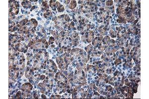 anti-Ribophorin 1 (RPN1) antibody