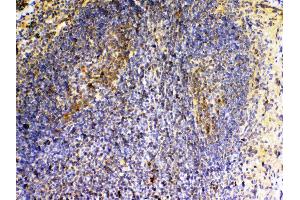 IHC analysis of VEGFB using anti-VEGFB antibody .