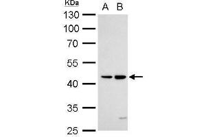 WB Image DR3 antibody detects TNFRSF25 protein by Western blot analysis. (DR3/LARD anticorps  (Center))