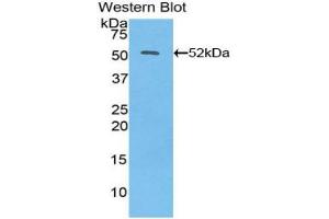Western blot analysis of the recombinant protein. (IFNB1 anticorps  (AA 22-187))