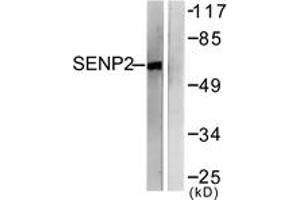 Western blot analysis of extracts from MDA-MB-435 cells, using SENP2 Antibody. (SENP2 anticorps  (AA 481-530))