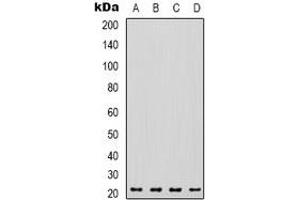 Western blot analysis of VEGFA expression in A549 (A), K562 (B), mouse liver (C), rat heart (D) whole cell lysates. (VEGFA anticorps)
