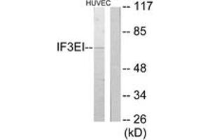 Western blot analysis of extracts from HuvEc cells, using IF3EI Antibody. (EIF3L anticorps  (AA 1-50))