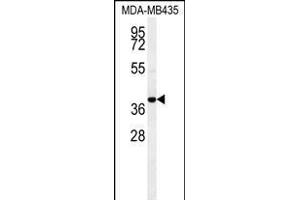 CCR8 Antibody (C-term) (ABIN654442 and ABIN2844176) western blot analysis in MDA-M cell line lysates (35 μg/lane). (CCR8 anticorps  (AA 305-335))
