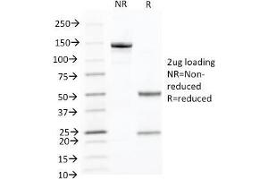 SDS-PAGE Analysis Purified Cytokeratin 10 Monoclonal Antibody (KRT10/844). (Keratin 10 anticorps)