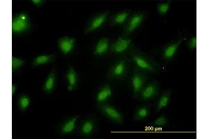 Immunofluorescence of monoclonal antibody to PSMB6 on HeLa cell.