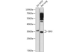 Western blot analysis of extracts of various cell lines, using SIX3 antibody (ABIN7270319) at 1:1000 dilution. (SIX3 anticorps)