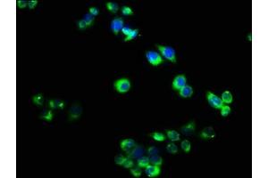 Immunofluorescence staining of PC-3 cells with ABIN7173868 at 1:40, counter-stained with DAPI. (RELT anticorps  (AA 26-153))