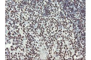 Image no. 6 for anti-Non-POU Domain Containing, Octamer-Binding (NONO) (AA 184-385) antibody (ABIN1491073) (NONO anticorps  (AA 184-385))