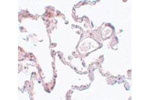 Immunohistochemistry (IHC) image for anti-Pleckstrin Homology Domain Containing, Family M (With RUN Domain) Member 1 (PLEKHM1) (N-Term) antibody (ABIN1031519) (PLEKHM1 anticorps  (N-Term))