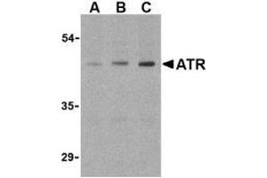 Western blot analysis of ATR in HepG2 cell lysates with this product atR antibody (IN) at (A) 0. (ANTXR1 anticorps  (Intermediate Domain))