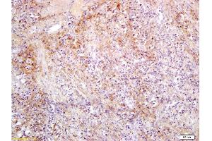 Formalin-fixed and paraffin embedded rat colon carcinoma labeled with Anti-Slc22A17 Y Polyclonal Antibody, Unconjugated  at 1:300, followed by conjugation to the secondary antibody and DAB staining (SLC22A17 anticorps  (AA 475-538))