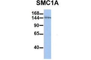 Host:  Rabbit  Target Name:  SMC1A  Sample Type:  Human Jurkat  Antibody Dilution:  1.